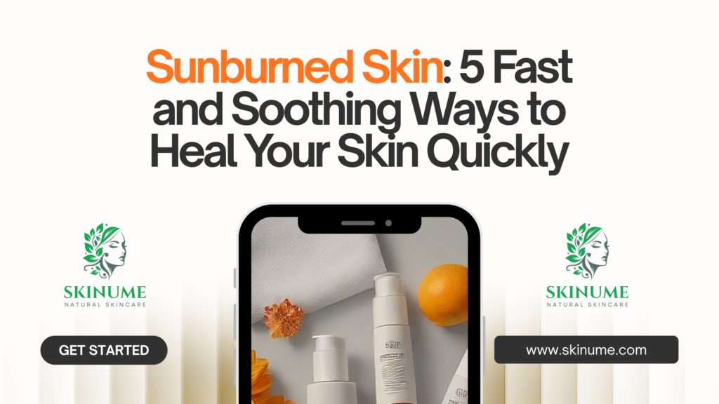 Sunburned Skin: 5 Fast and Soothing Ways to Heal Your Skin Quickly